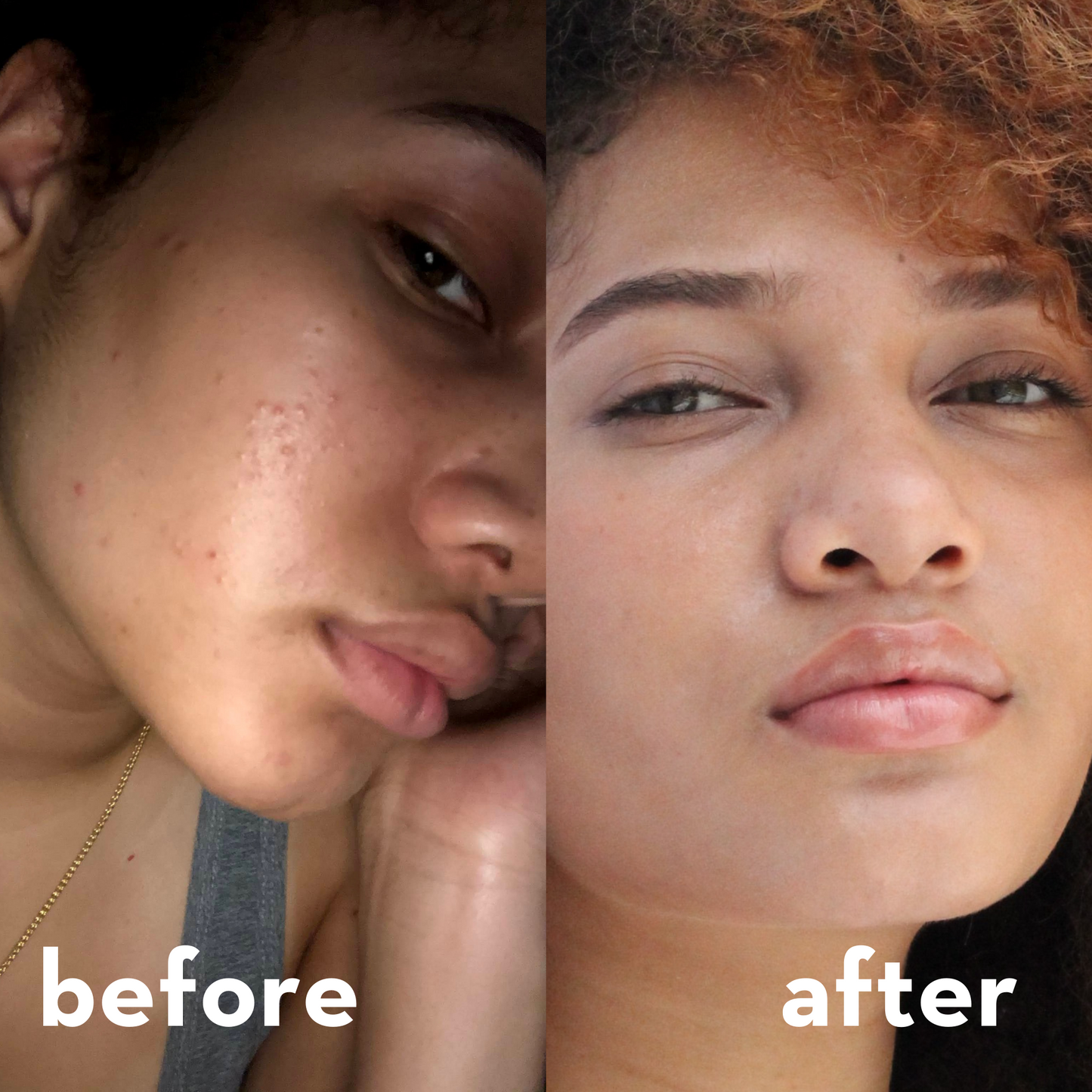 Healing Face Cleanser